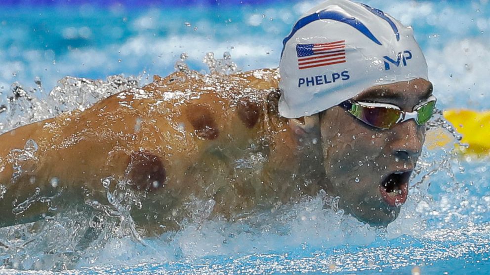 Rio Olympics: Why Michael Phelps Has Polka Dot Patterns on His Shoulder ...