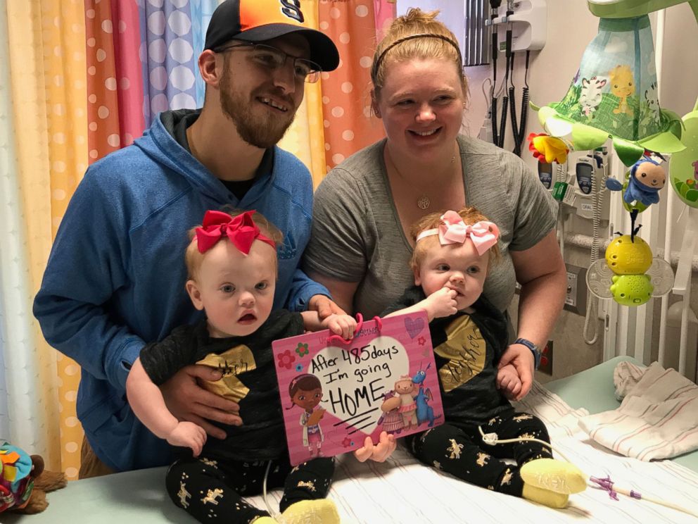 PHOTO: A pair of formerly conjoined twins are being discharged from the hospital just in time for Thanksgiving after a successful surgery to separate them.