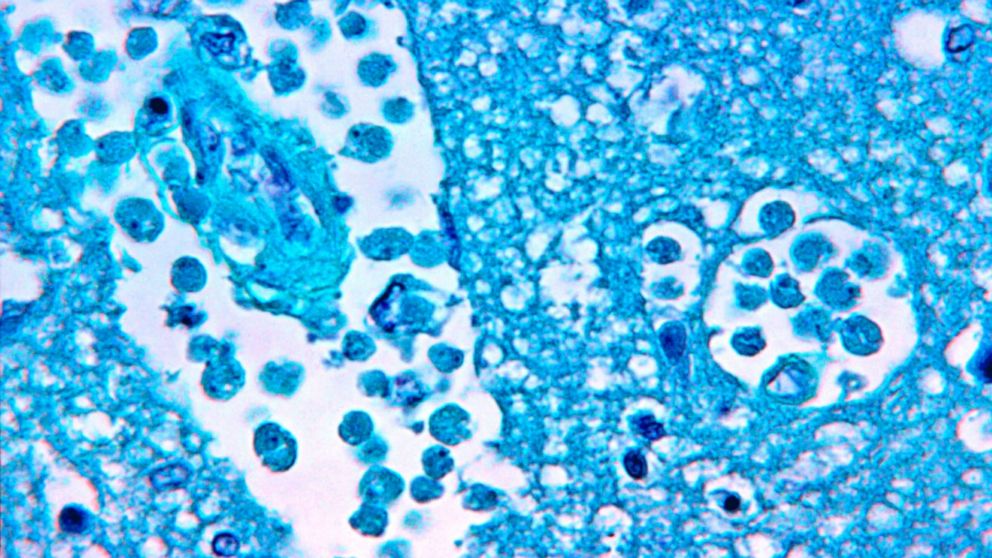 Brain-eating amoeba found in 2 water systems