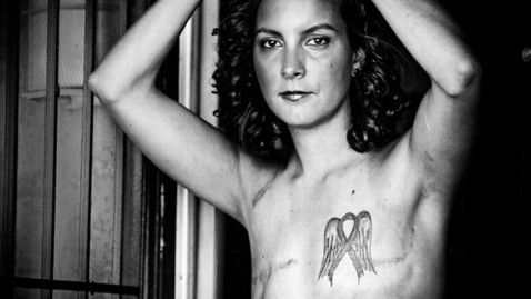  Facebook Allows Mastectomy Photos, Not Nudity