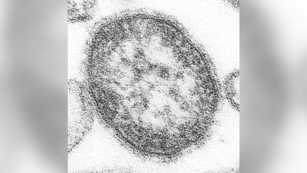 College Student With Measles Boarded Train at Penn Station