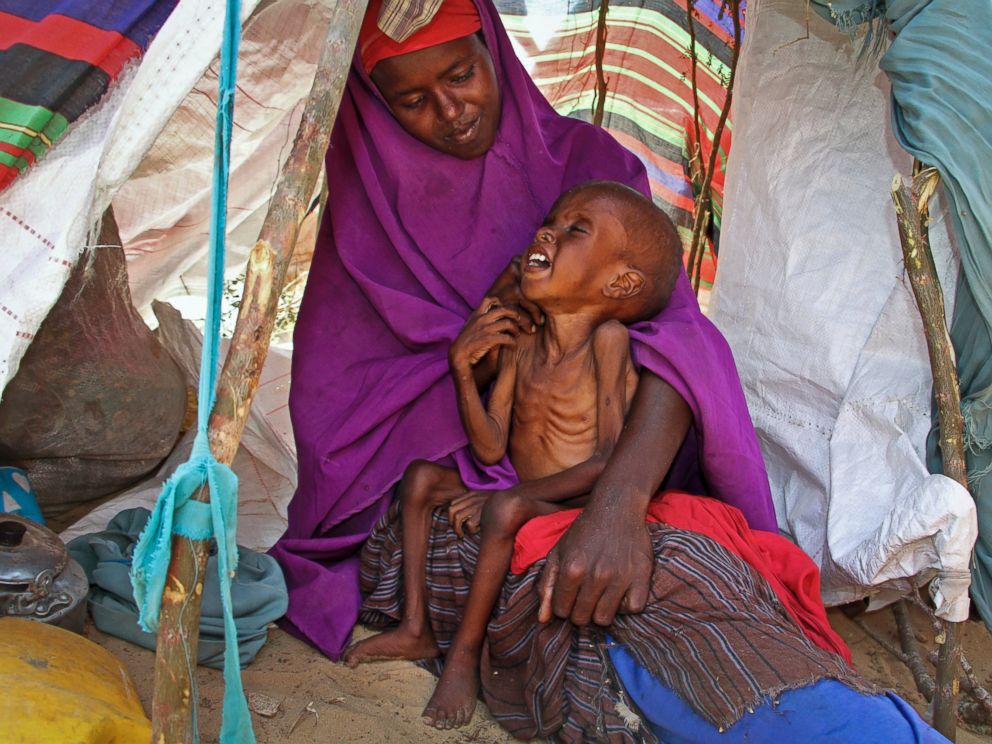 PHOTO: Newly displaced Somali mother Sahra Muse, 32, comforts her malnourished child Ibrahim Ali, 7, in their shelter at a camp in the Garasbaley area on the outskirts of Mogadishu, Somalia, March 28, 2017.