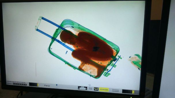 X-Ray Scan Uncovers Boy Smuggled in a Suitcase 
