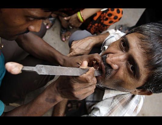 gty_india_roadside_dentist_150861418_ll_120828_ssh.jpg