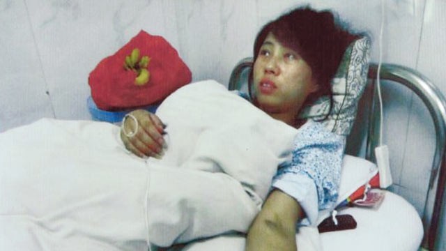 PHOTO: Feng Jianmei is shown after having her 7-month-old fetus aborted because she was in violation of China?s one baby policy.