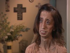 Lizzie Velasquez on Choosing to Fight Bullies: 'I Wanted To Have ...