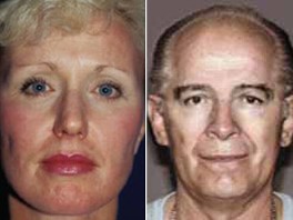 FBI Using Wife's Plastic Surgery to try and Find Whitey Bulger - ABC News