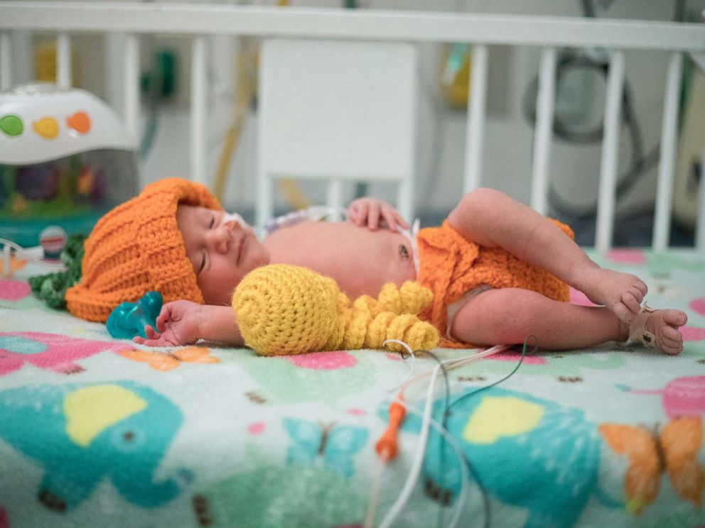 PHOTO: One of the NICU patients, Angela, is dressed up in one of Fankhausers knitted costumes as a pumpkin.