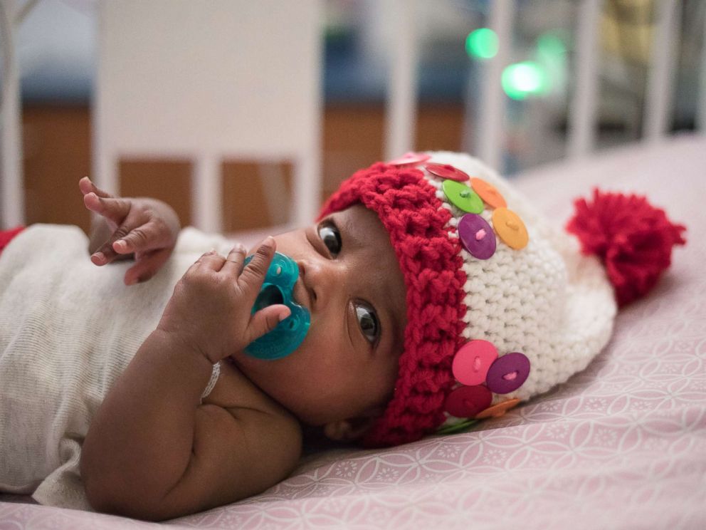 PHOTO: Childrens Healthcare of Atlantas NICU nurse Tara Fankhauser knit costumes for patients like Charleigh, who dressed as a gumball machine.