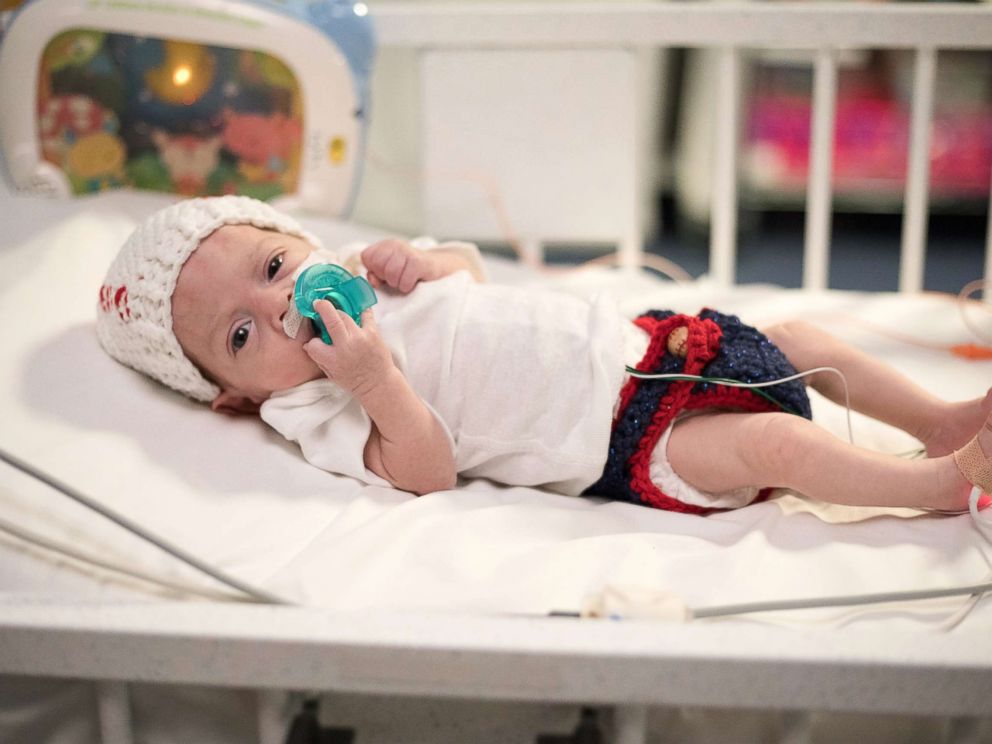 PHOTO: Fitted in a hat knit as a baseball and cute blue shorts, Giovanni, one of CHOAs NICU babies, is ready for Halloween.