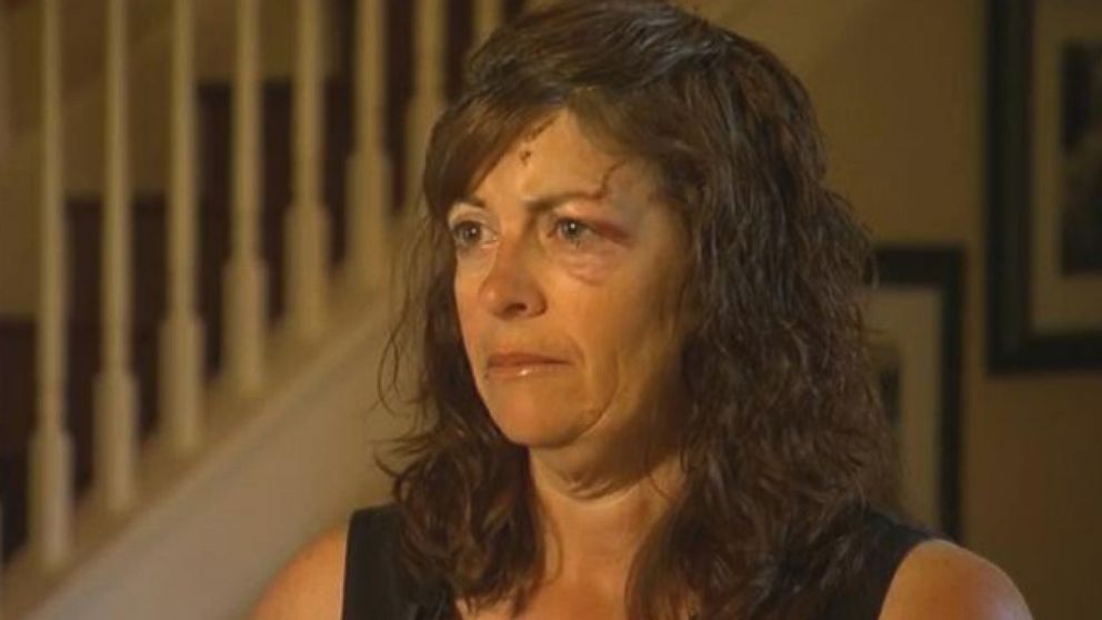 Woman Who Survived Brutal Bear Attack Speaks Video - ABC News